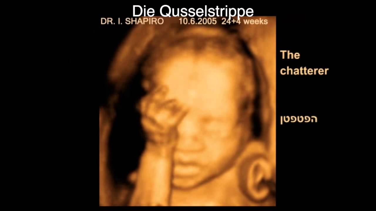 3D-Baby-Ultraschall - Was Babies so im Mutterleib machen?
