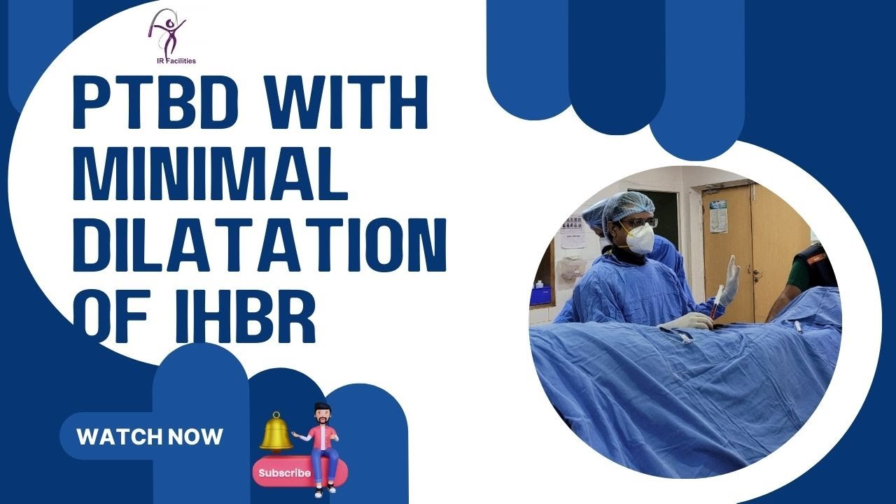 PTBD with Minimal Dilatation of IHBR | IRFACILITIES