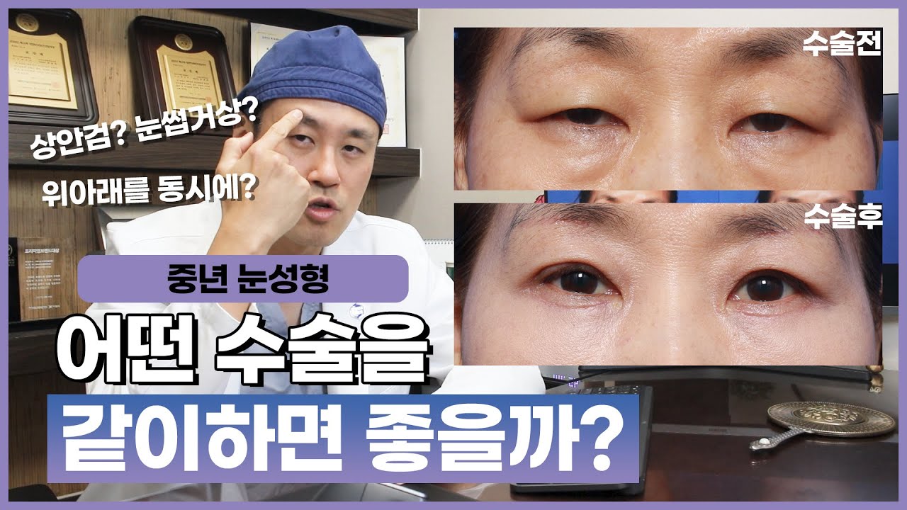 상안검수술 눈썹하거상술 하안검수술 , 같이 하는게 좋을까? 아님 따로? # 중년눈성형 잘하는 병원
