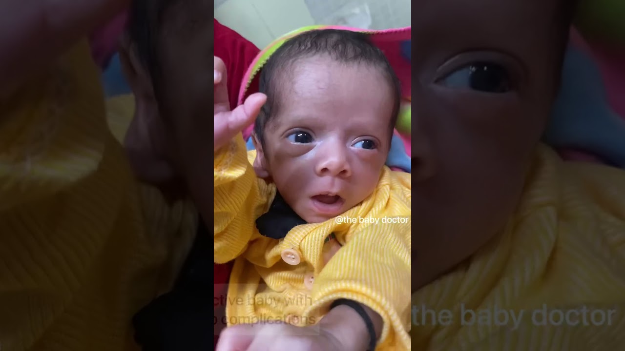 Success story of newborn 990 gram - 1.65 kg | the baby doctor#happiness #newborn #shorts #ytshorts