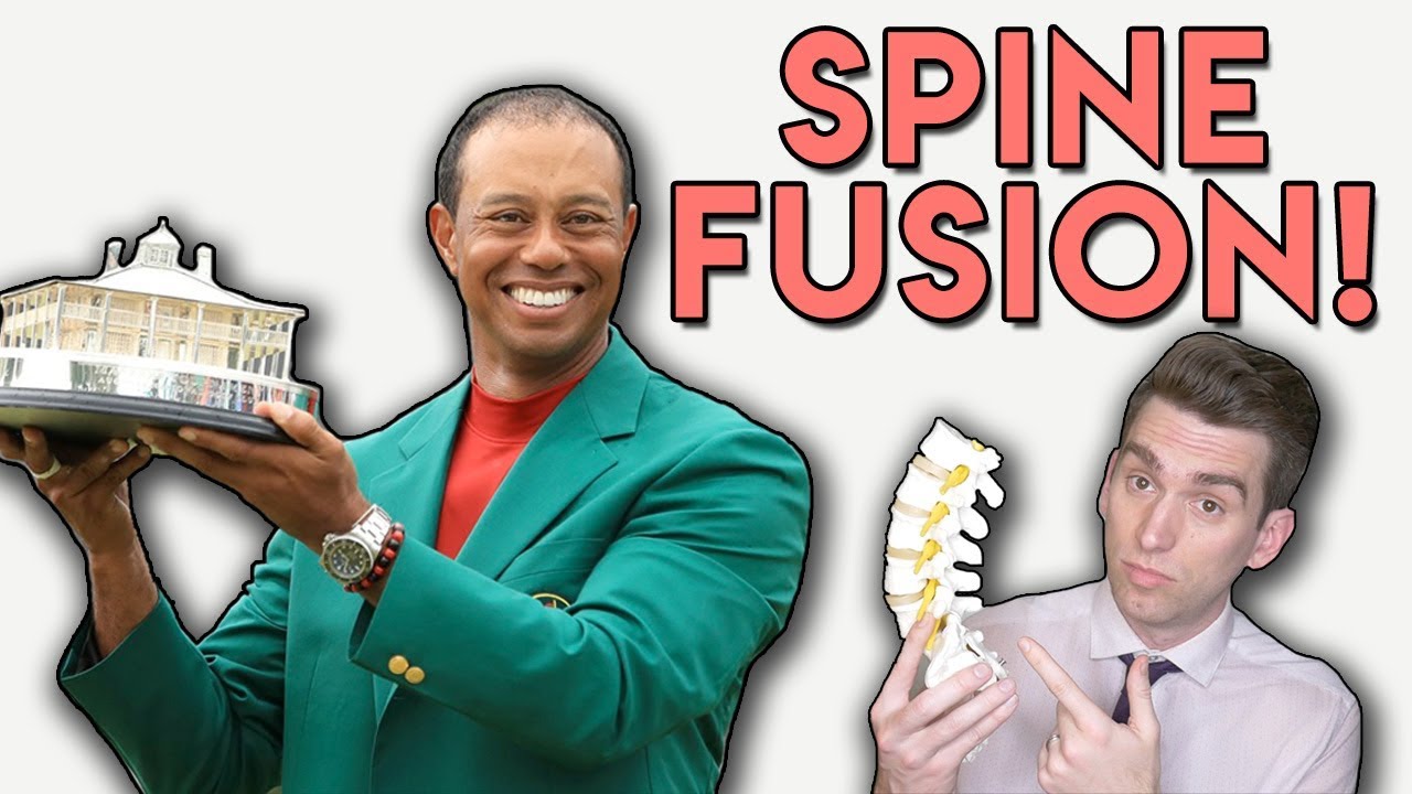 Tiger Woods SPINE FUSION Explained by Doctor!