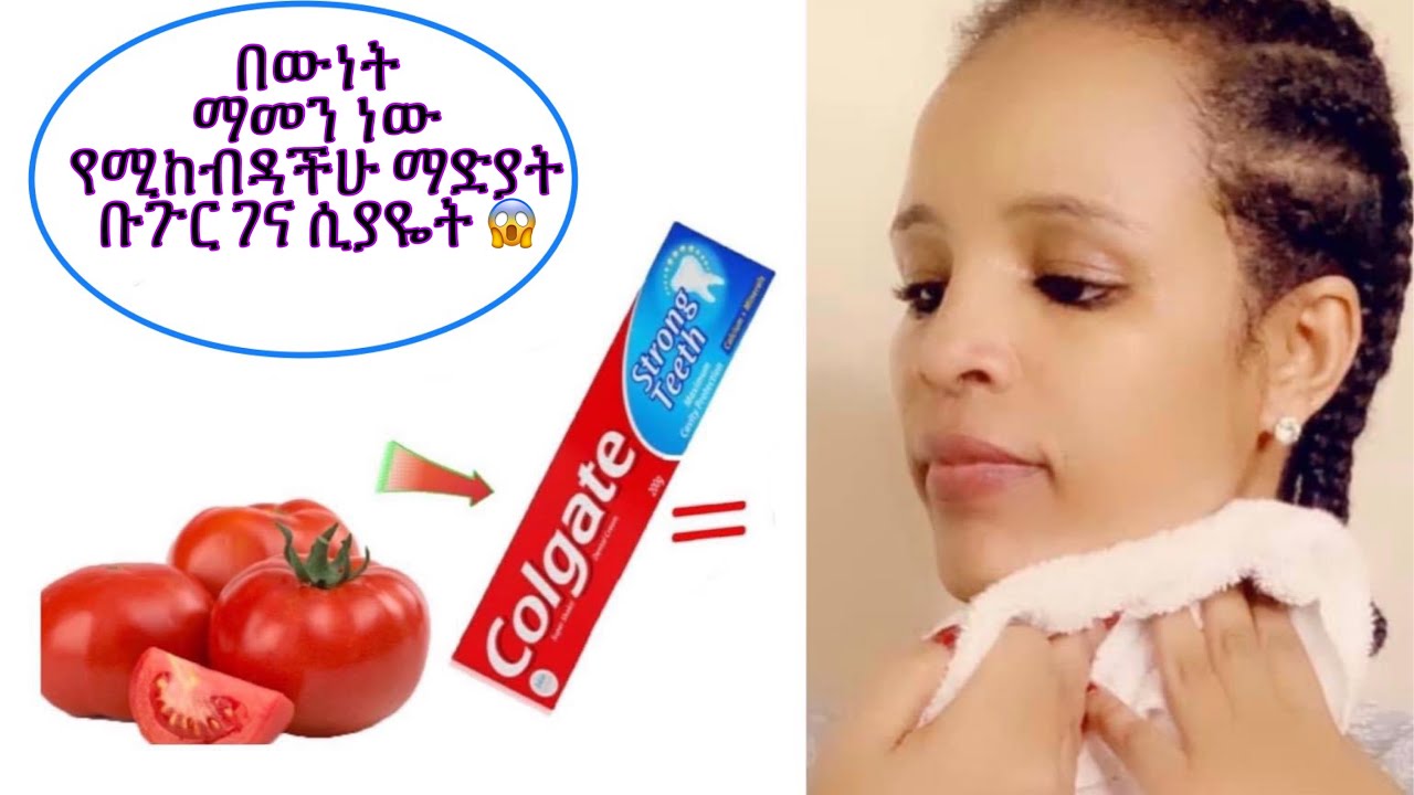 በውነት ማመን ነው የሚከብዳችሁ ማድያት ቡጉር ገና ሲያዬት 😱 how to make tomato & colgate facial mask ethiopian beauty
