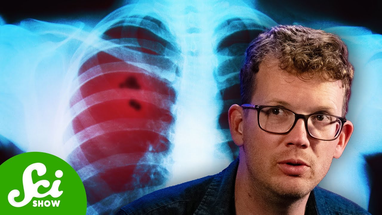 Why Is Lung Cancer in Non-smokers on the Rise?
