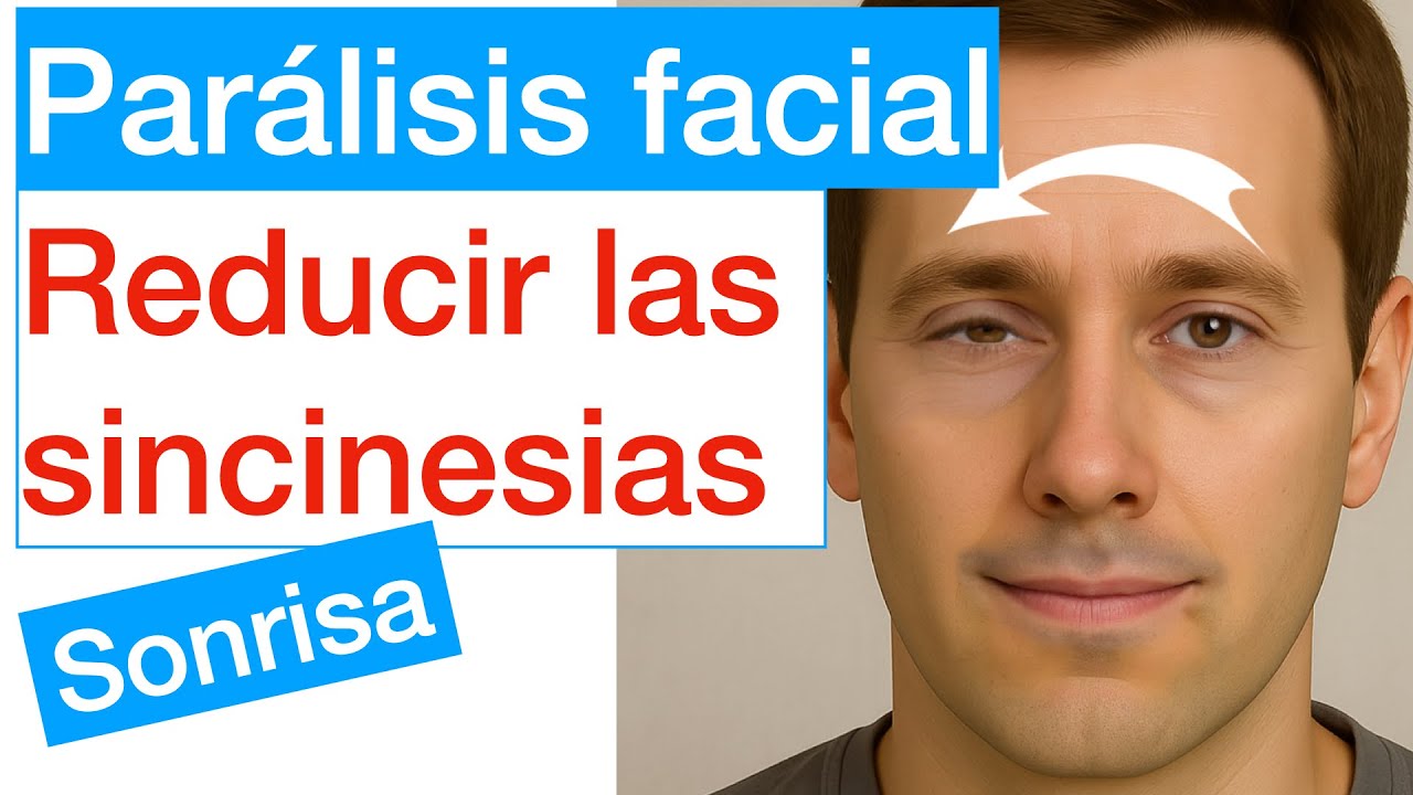 PARÁLISIS FACIAL - REDUCIR SINCINESIA, SEQUELAS, Cierre involuntario del ojo al sonreír