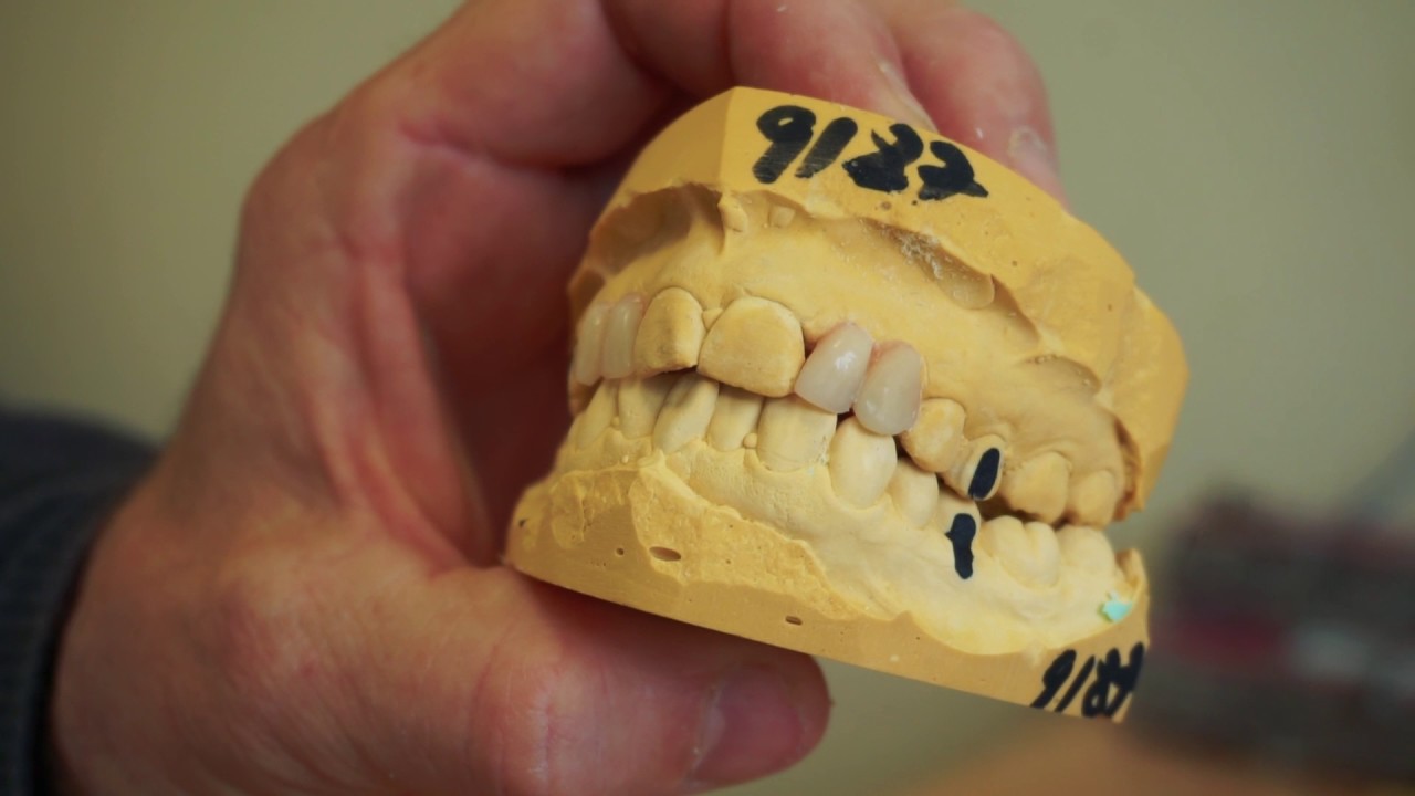 Ronan Kelly's Ireland   Selling Second hand False Teeth in Limerick