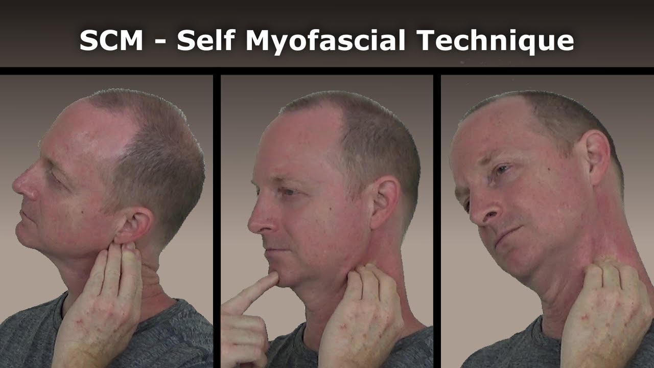 SCM Self Myofascial Release Technique