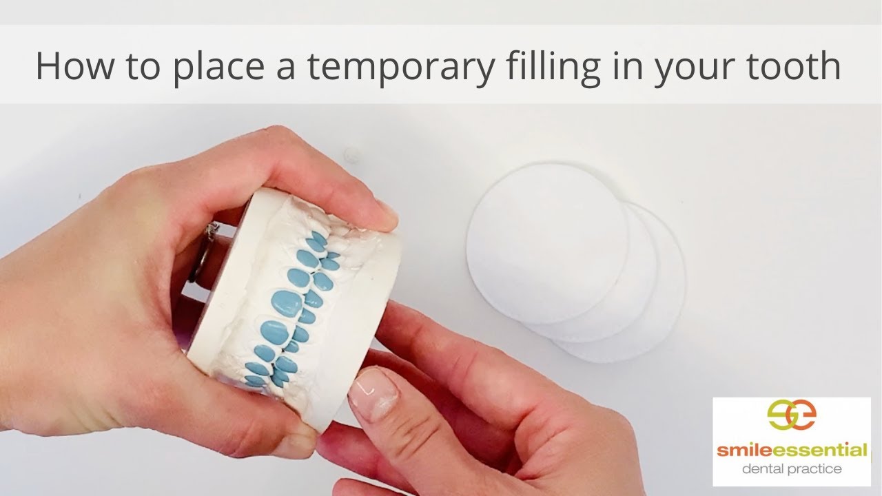How to place a temporary filling in your tooth