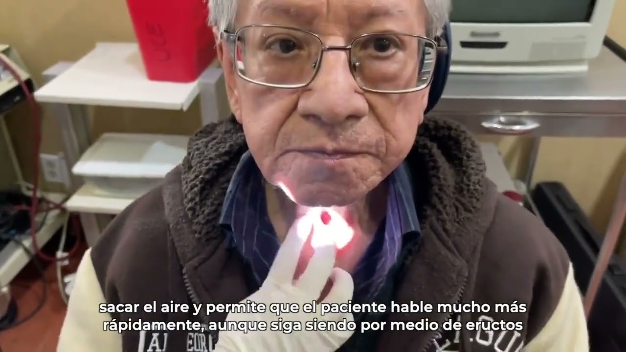 Prótesis fonatoria ayuda a que pacientes con #Laringectomía recuperen más rápido la voz.