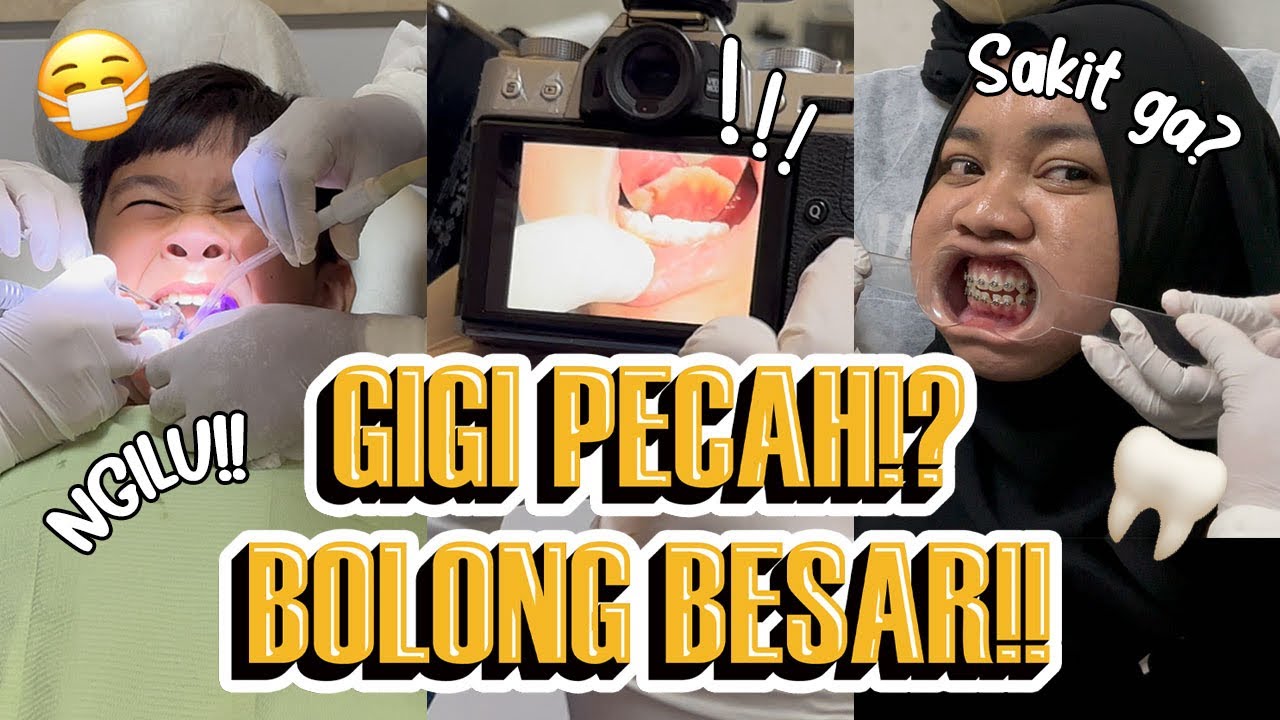 NGILU!!! GIGI AA BOLONG BESAR UNTUNG ADA CLINIC GIGI TITA