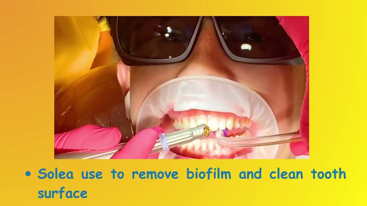 Pediatric Dental Trauma in Los Angeles Chipped Displaced and Knocked Out Teeth #dentalcare #trauma