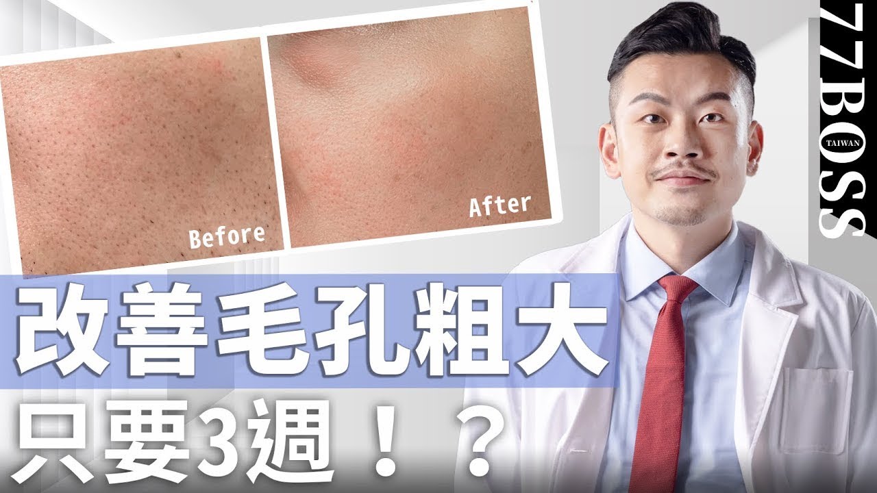 毛孔粗大、黑頭一堆？超有效必買保養品清單，21天效果好到哭！【77老大】