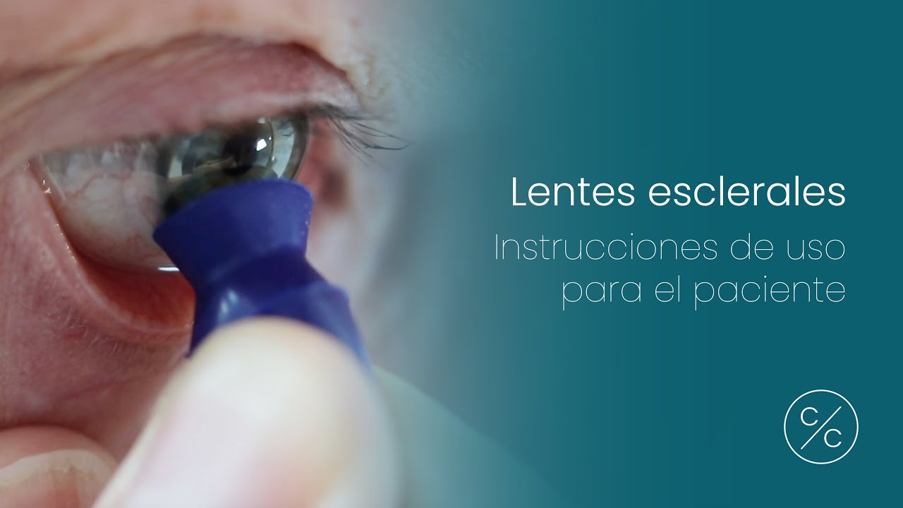 Lentes esclerales - Instrucciones de uso para el paciente