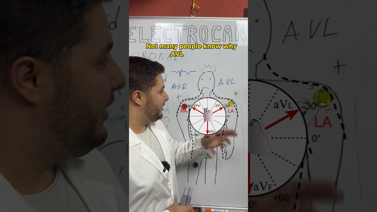 ECG - AVL Explained 🤓 #medicalstudent #medicaleducation #futuredoctor #ecg #medical #ninjanerd