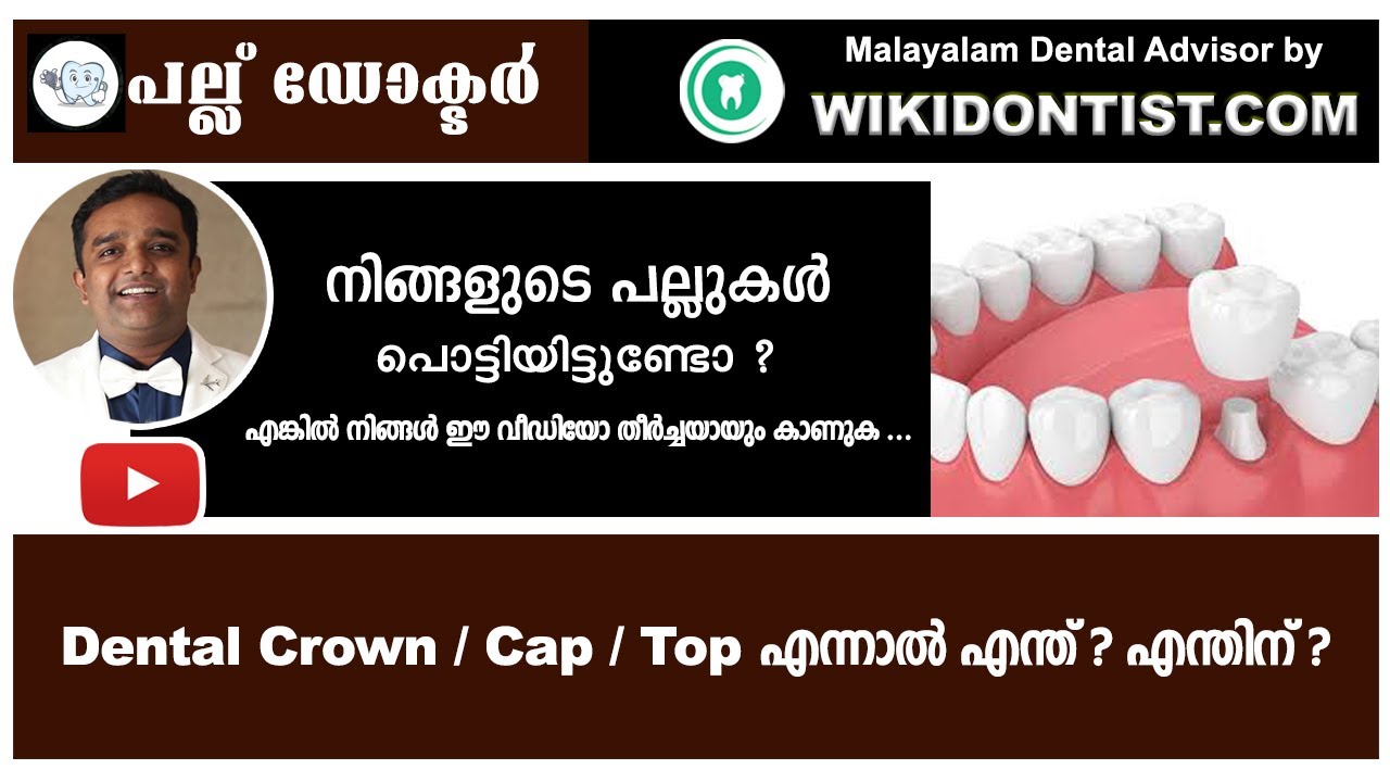 Dental Crown / Cap / Top എന്നാൽ എന്ത്? എന്തിന്? /Malayalam Dental Videos/മലയാളം/Dr.Thomas nechupadam