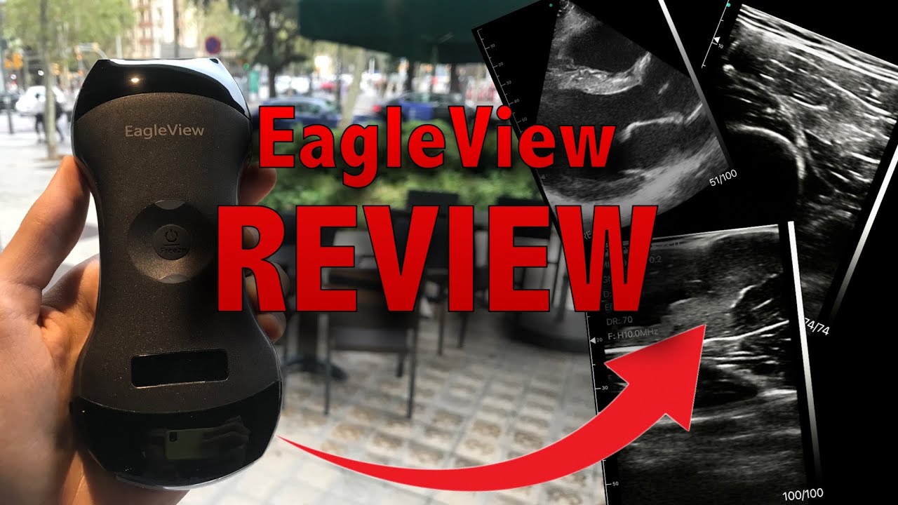 EagleView Ultrasound Complete Review 💯| with 12% discount code 