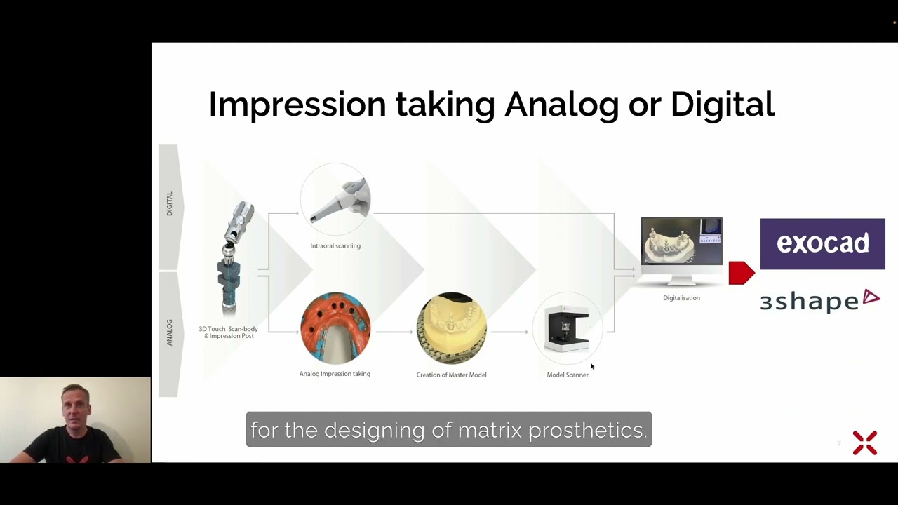 matrix® Impression Taking | matrix® Digital Academy