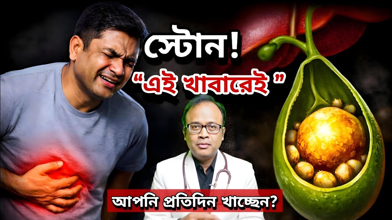 💥ভয়াবহ হারে বাড়ছে অপারেশন এইরোগে । Gallbladder Stone Causes And Operation Why Increases In India