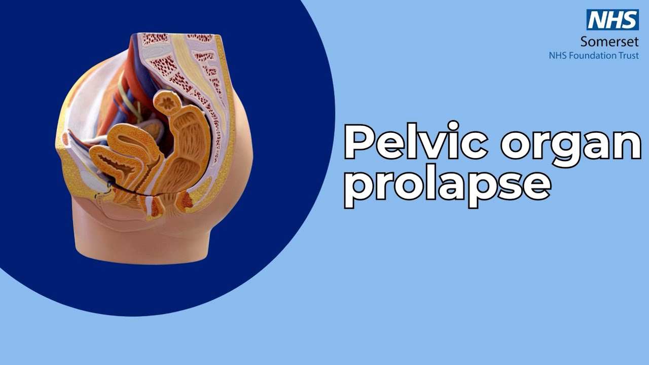 Pelvic organ prolapse