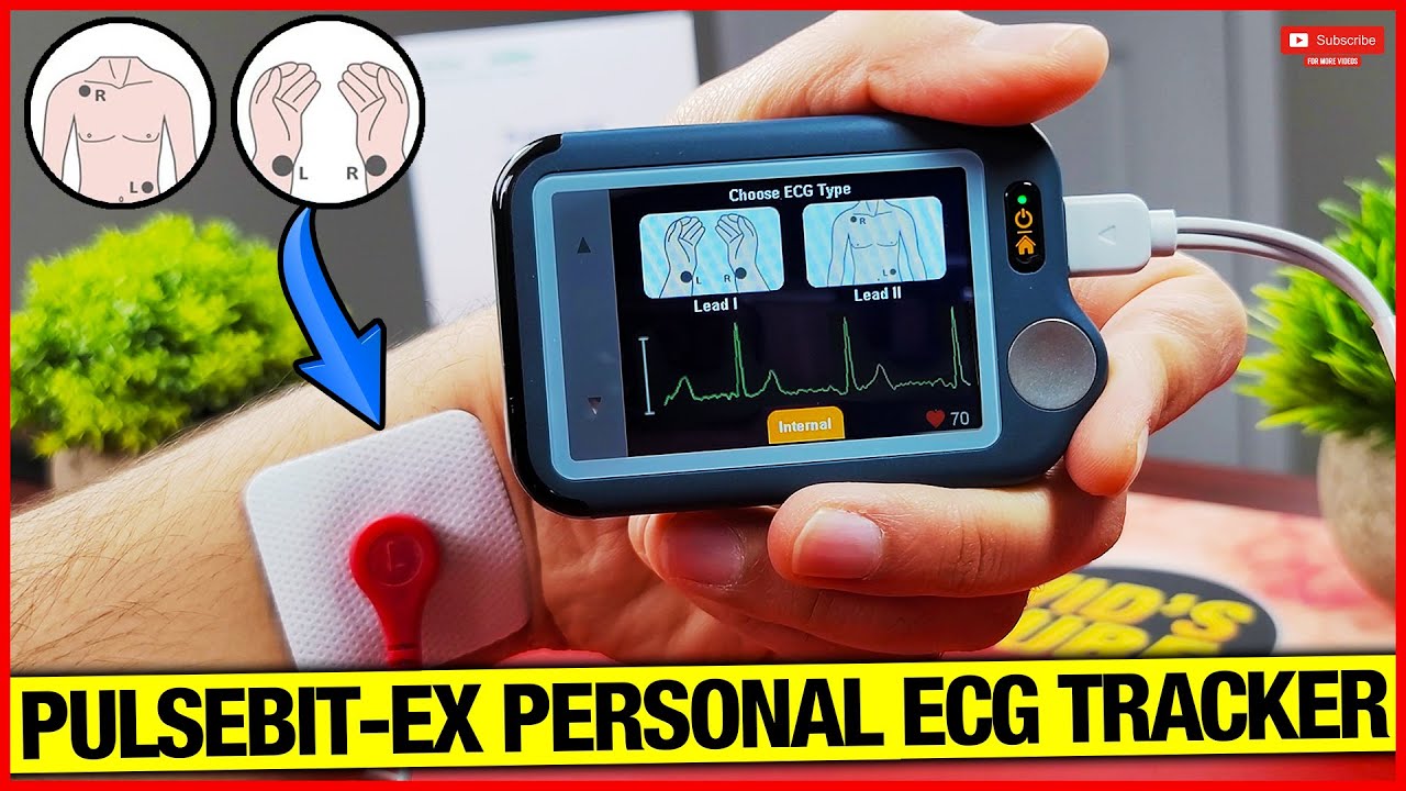 Персональный ЭКГ/ЭКГ-трекер Pulsebit EX Wellue Viatom!
