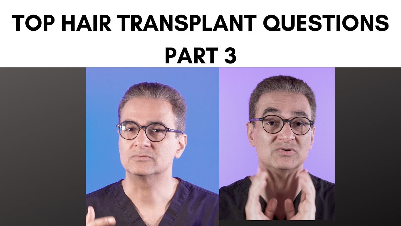 Top Hair Transplant Questions Answered (Part 3)