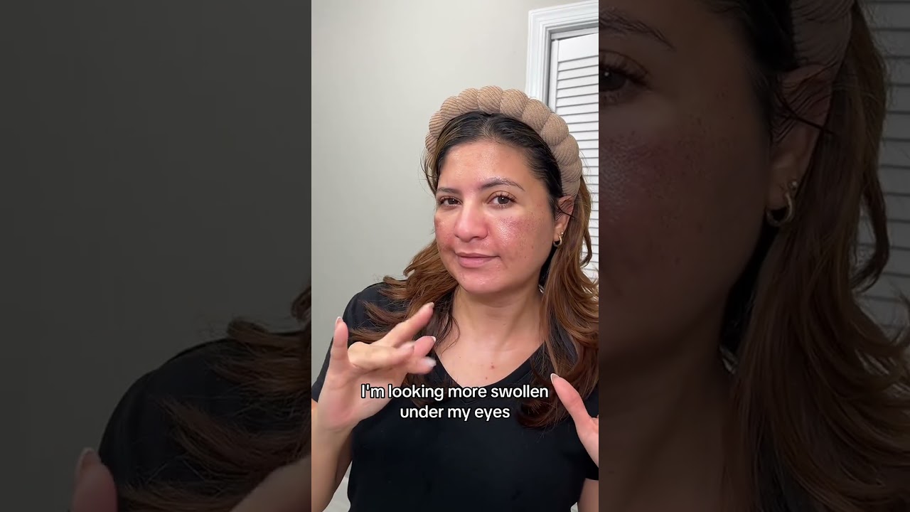 Halo Laser for Pigmentation & Large Pores! Skincare Routine + 