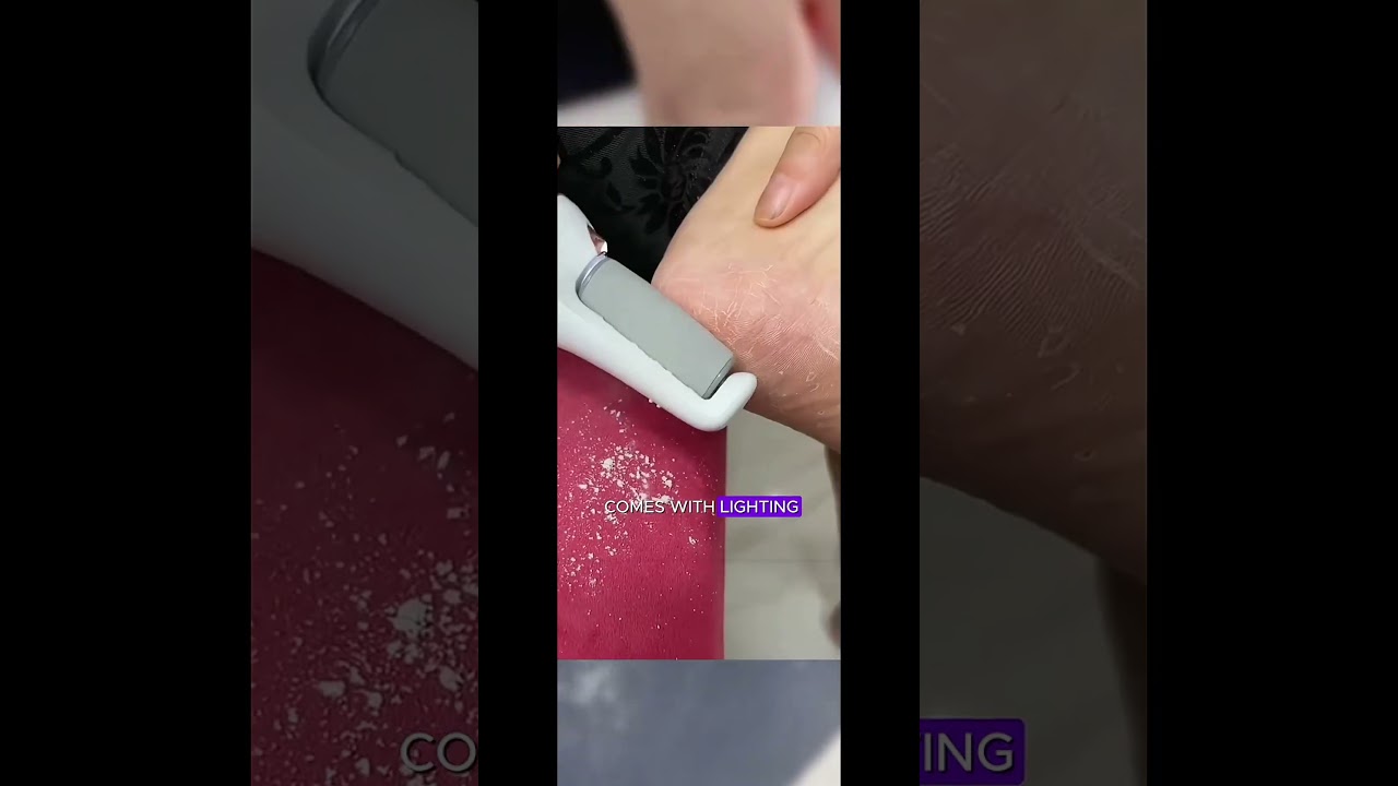Say Goodbye to Calluses! Electric Foot File for Smooth Feet in Seconds!