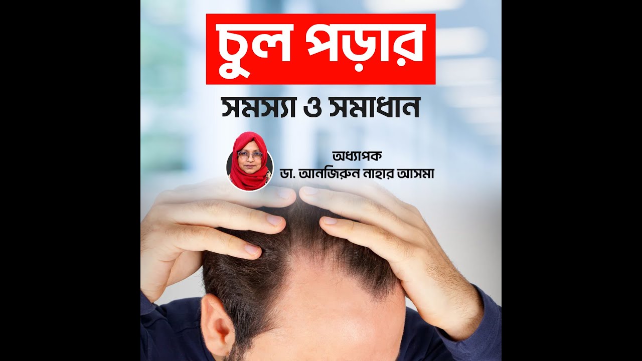 Hair Fall Treatment | চুল পড়ার সমস্যা কমাবেন যেভাবে