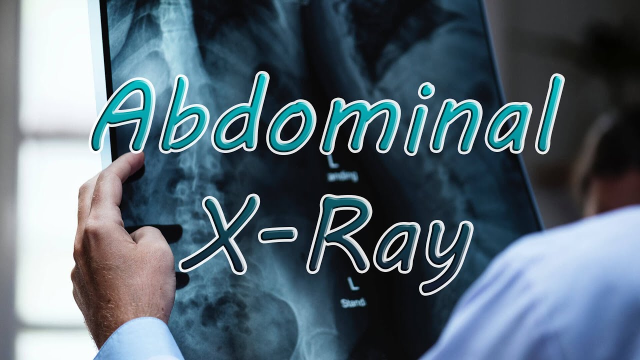 قراءة صورة البطن البسيطة (1) | المكونات الطبيعية | الصور الشعاعية الإسعافية