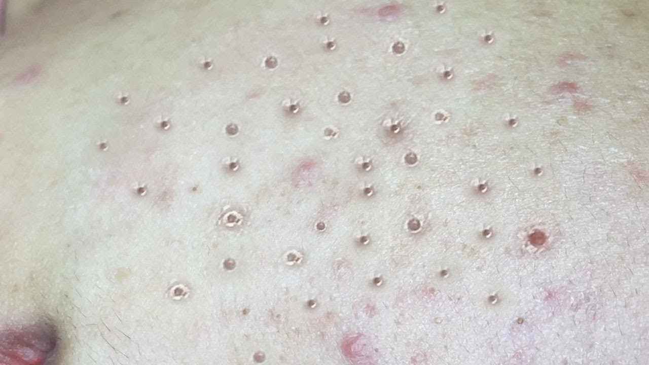 Satisfying Relaxing with Sac Dep Spa Video (#172)