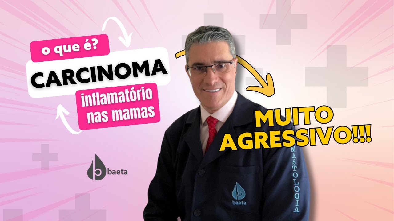 CARCINOMA INFLAMATÓRIO DE MAMA, O QUE É? | Dr. Adriano Baeta