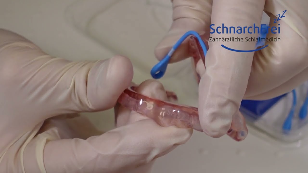 SomnoMed Avant - Vorschub dieser Unterkiefer-Protrusionsschiene verstellen