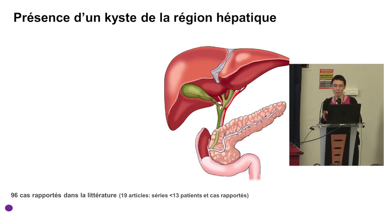 04   Diagnostic prénatal des anomalies anatomiques des voies biliaires