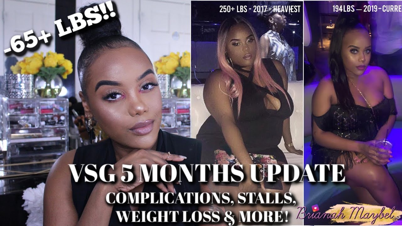 VSG UPDATE: MONTH 1 TO 5 | COMPLICATIONS, MEASUREMENTS, STALLS & MORE!