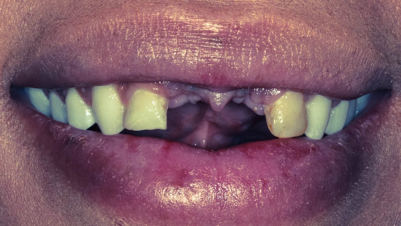 Before & After Smile Makeover Transformations at Innovative Dental of Springfield