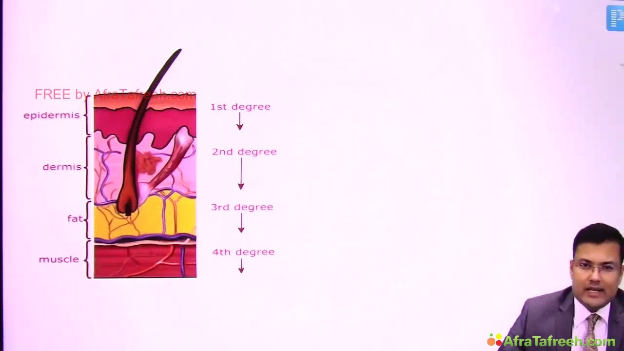 483 BURNS | SURGERY |