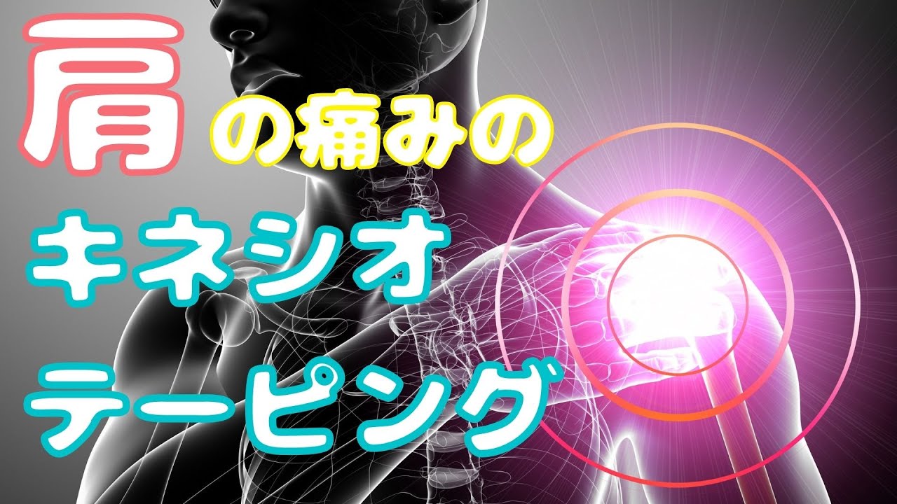 肩の痛みのキネシオテーピング