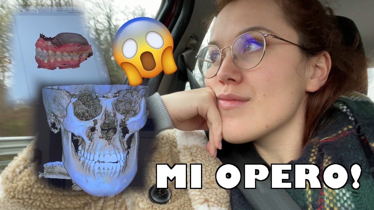 INTERVENTO ALLA MANDIBOLA: si parte!!! 😱 *Malocclusione III classe* 🎄VlogMas #1 | Arileigheas