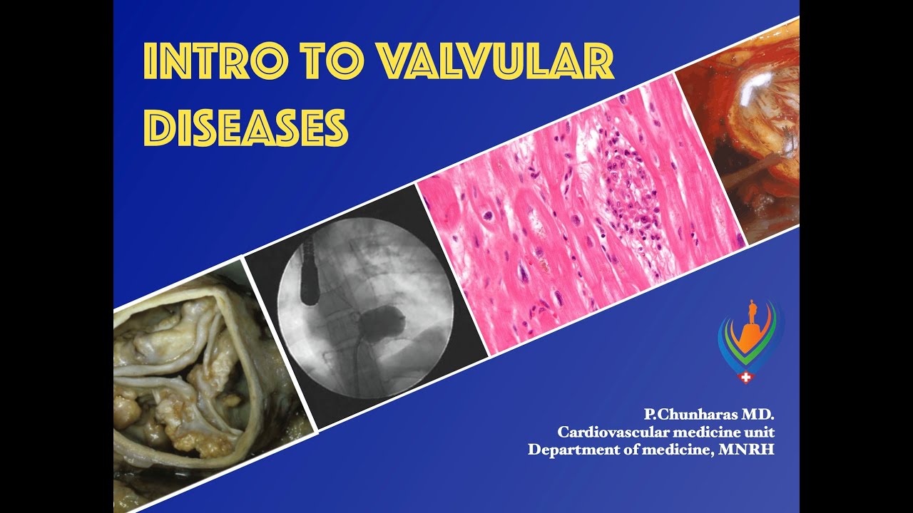 VHD1 -  basic physiology and symptoms