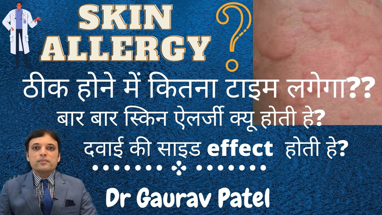 Skin allergy treatment | Skin rashes | #urticaria #skinallergytreatment