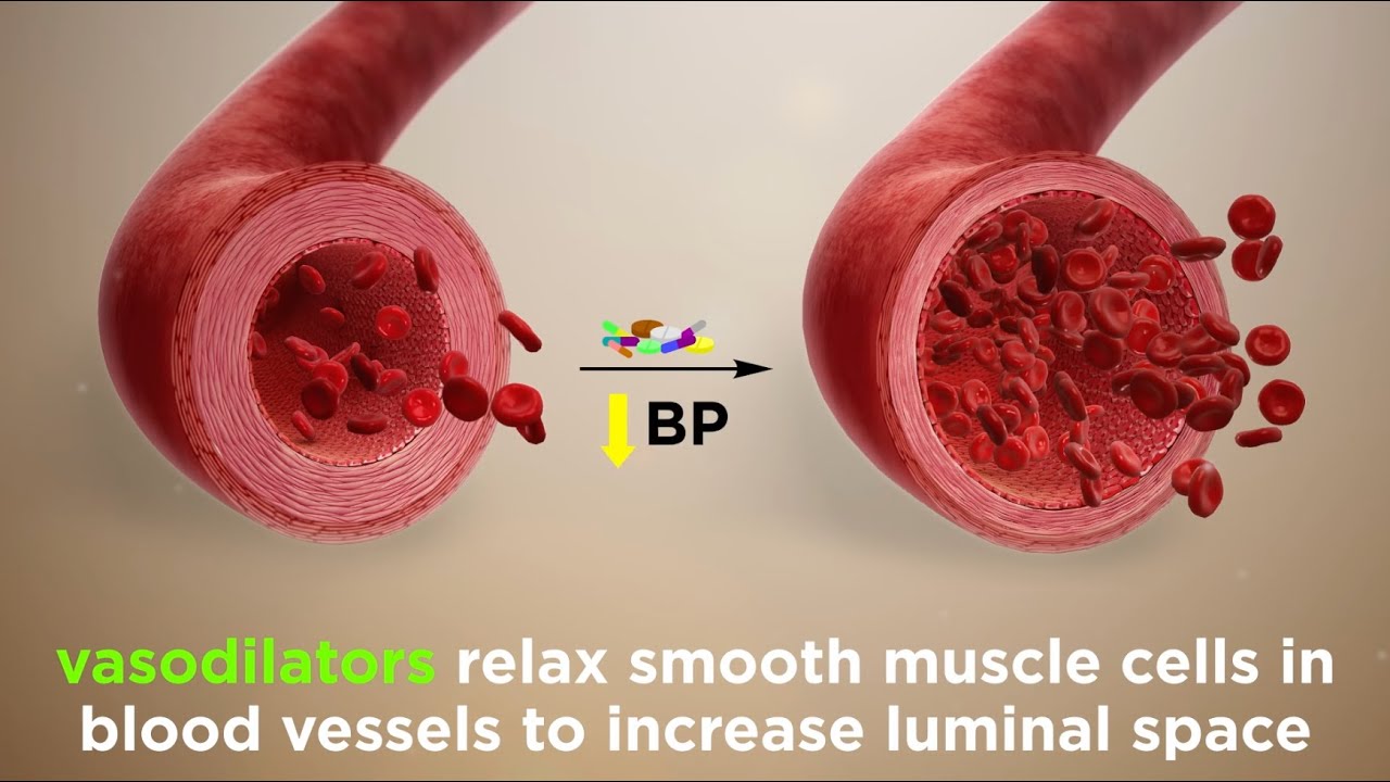 Vasodilators (Treating Hypertension)