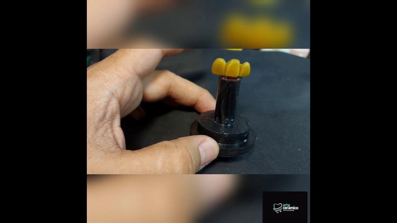 Técnica de Prensado Manual