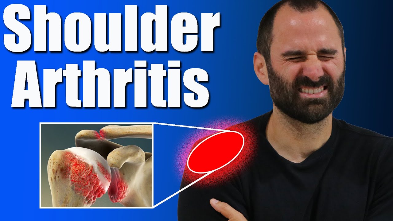 Shoulder Osteoarthritis.  Symptoms, Causes and Effective Exercises for Shoulder Pain Relief