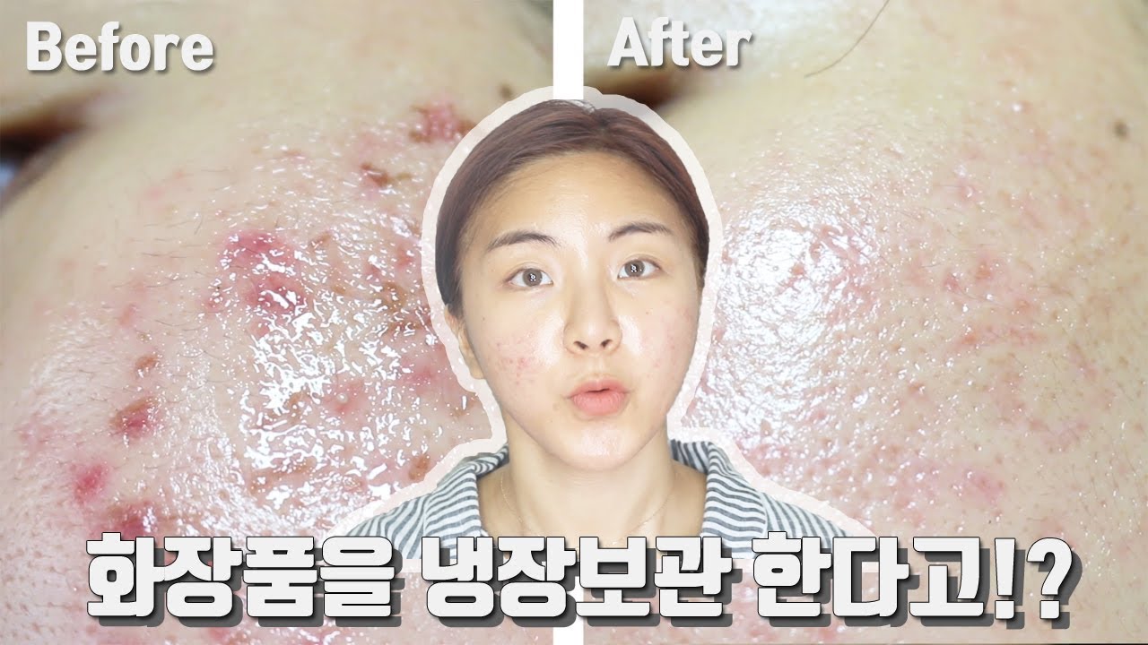민감성 피부에 진정 효과 좋았던, 라네즈 시카 슬리핑 마스크 2주 사용후기!!
