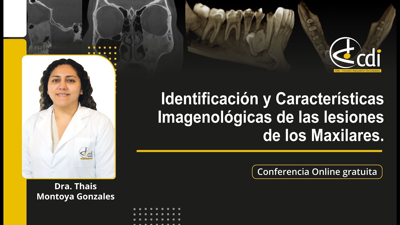 Conferencia Online: IDENTIFICACIÓN Y CARACTERÍSTICAS IMAGENOLÓGICAS DE LAS LESIONES DE LOS MAXILARES