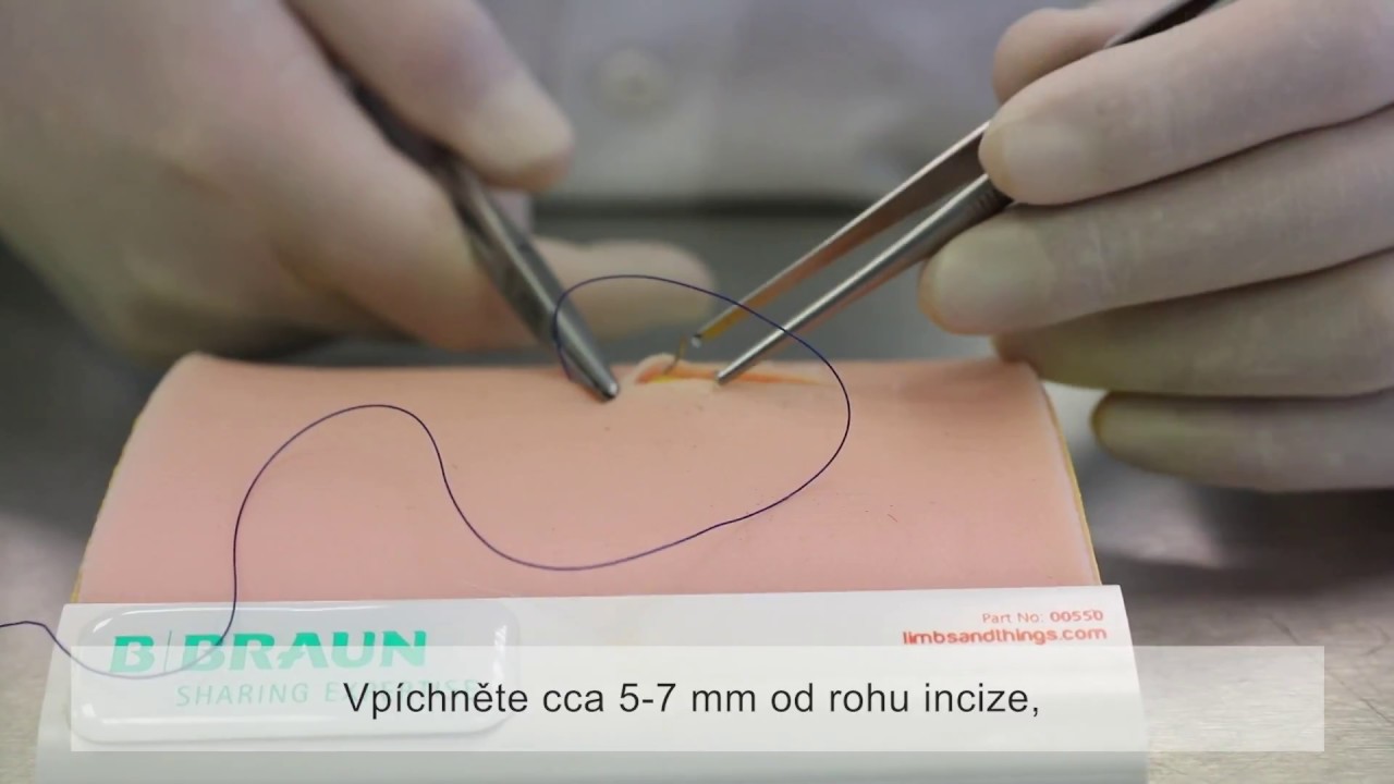 Chirurgické stehy: Intradermální steh (front view)