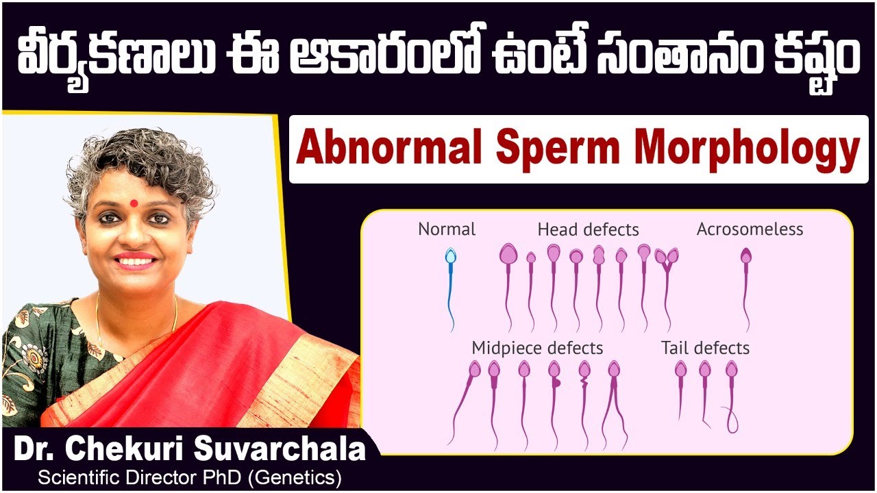 కణాలు ఈ ఆకారంలో ఉంటే || Does Sperm Morphology Affect Fertility? || Dr Chekuri Suvarchala || Ziva