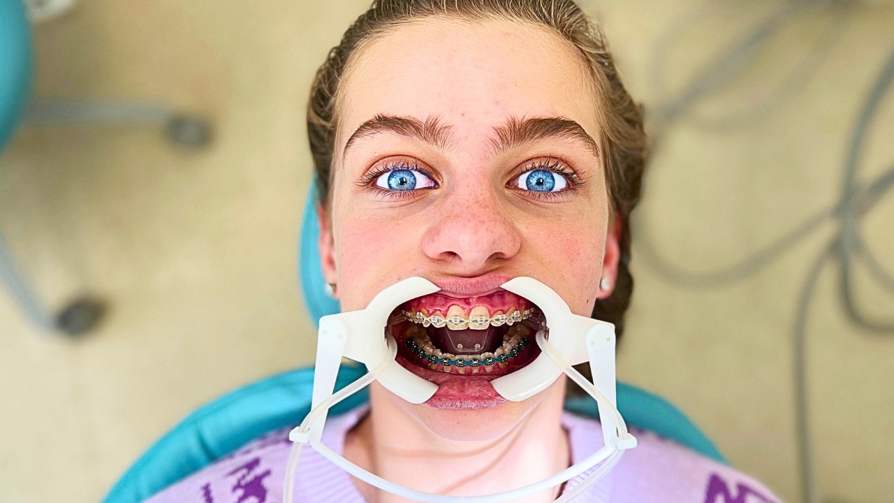 SOCKIE GOT BRACES & NOW SHE FEELS...