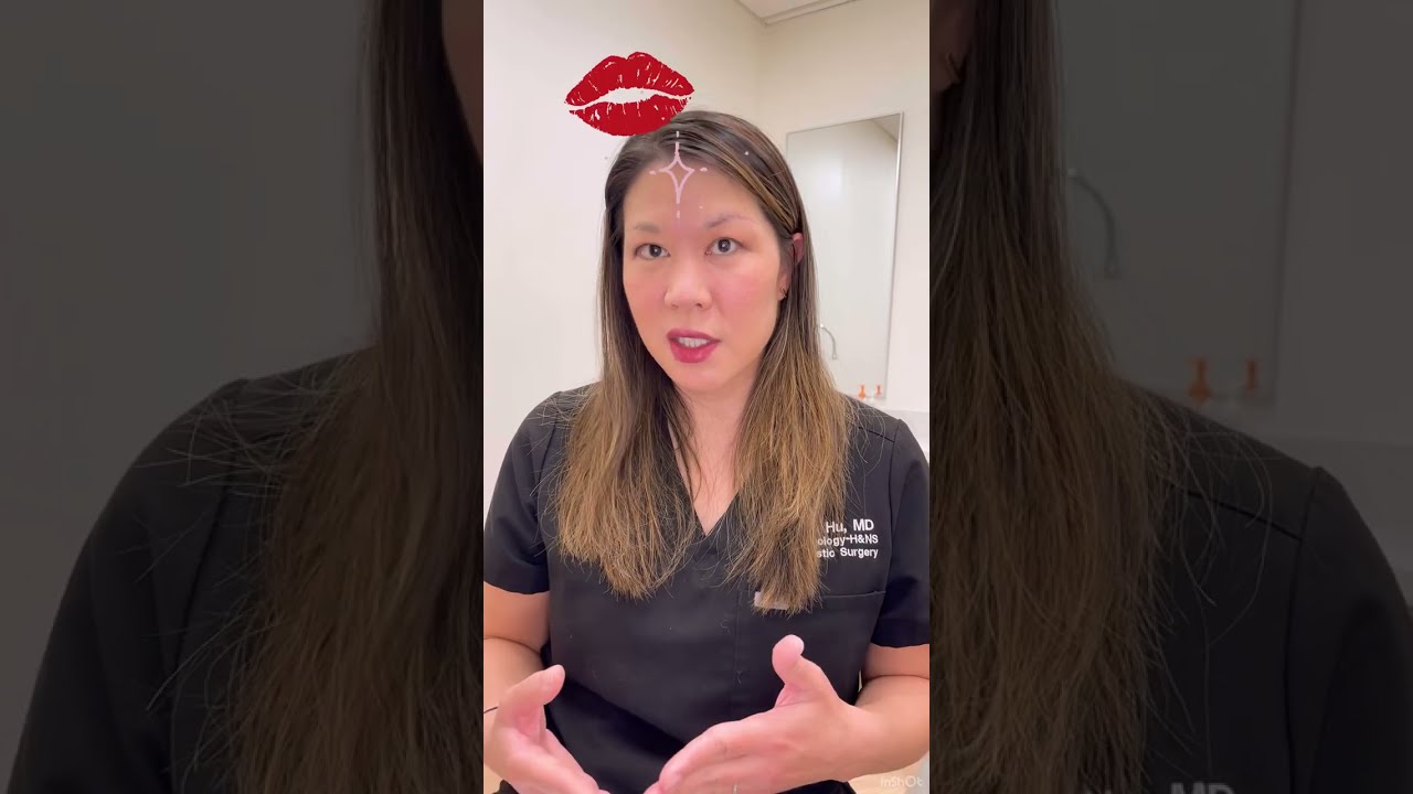 Dr. Hu’s Lip Fillers 101: Columns Support the Lips Too!