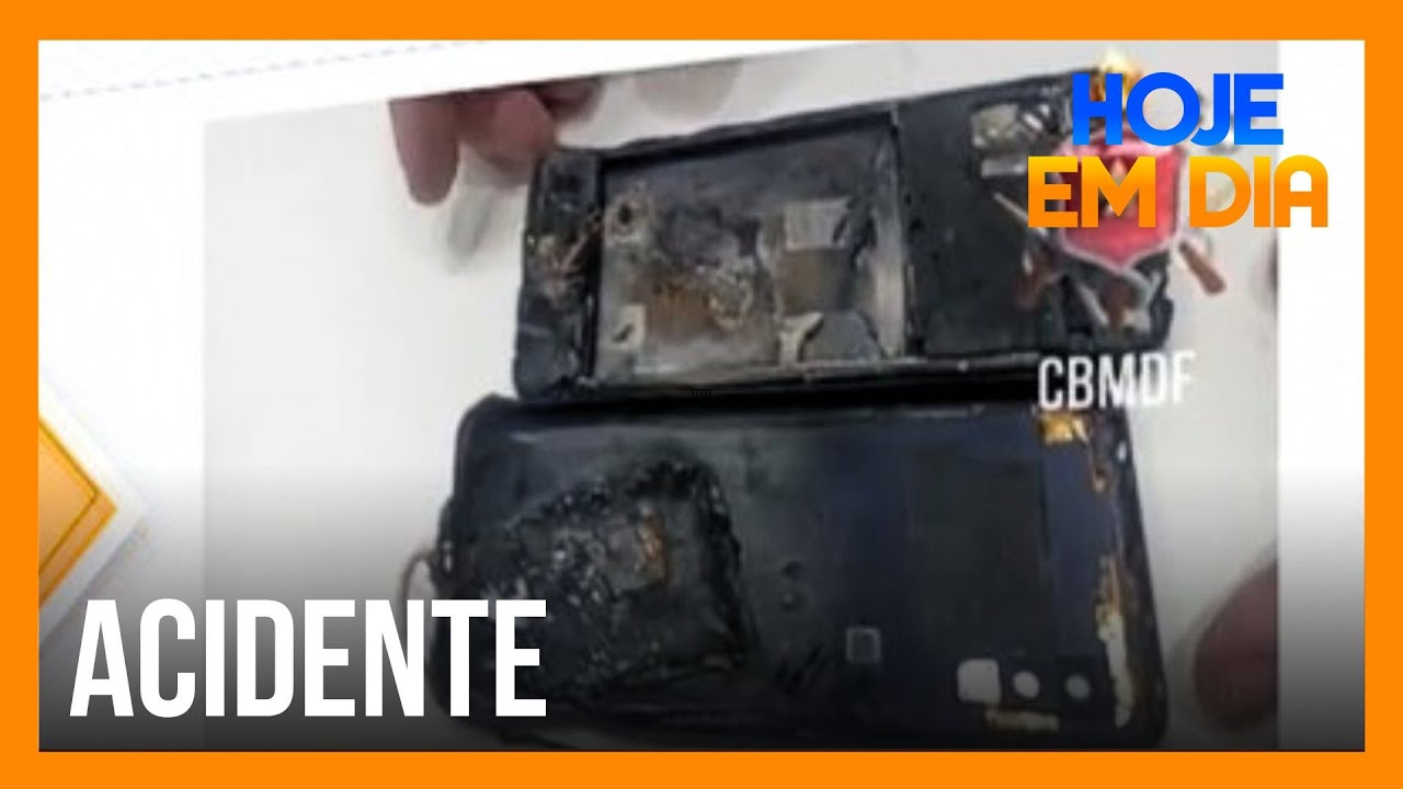 Celular explode enquanto carrega, causando queimaduras em jovem