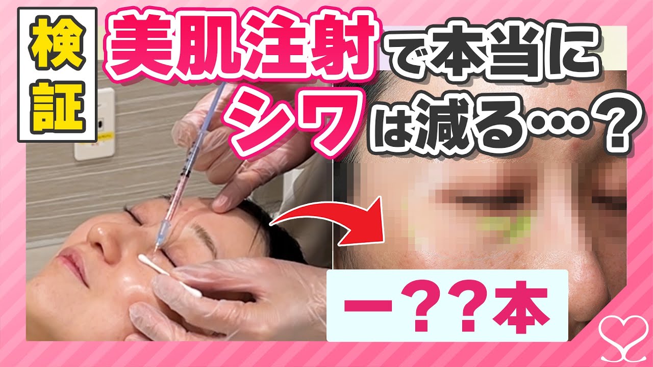 【シワがなくなる！？】美肌注射 本当に効果があるのか検証したら すごかった・・・！！